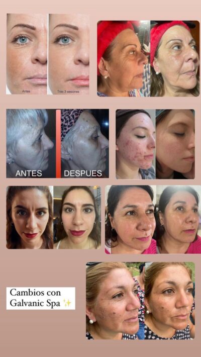 Sistema ageLOC Galvanic Face Spa - Imagen 2