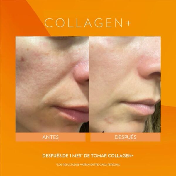 Colágeno - Collagen + - Imagen 3